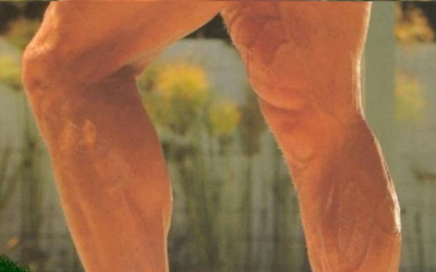 Mwyi2i5.png?width=400&height=250